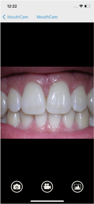 mouthcam instructions